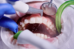 Созданы способные чистить зубы нанороботы